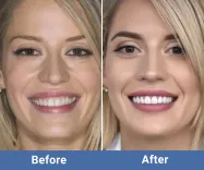 Before image for Margaret Foster,42