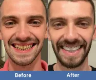 Before image for Robert Hughes,31